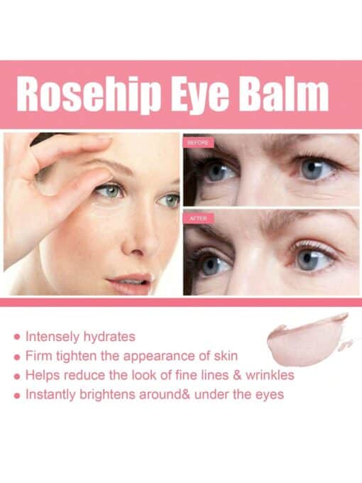 SHEIN 3g Rosehip Eye Cream Stick To Diminish Eye Bags, Moisturize, Smooth Wrinkles And Firm Eye Area Skin - Image 2