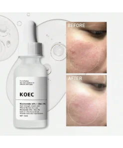 SHEIN KOEC Niacinamide 10% + Zinc 1% Facial Serum 30ml