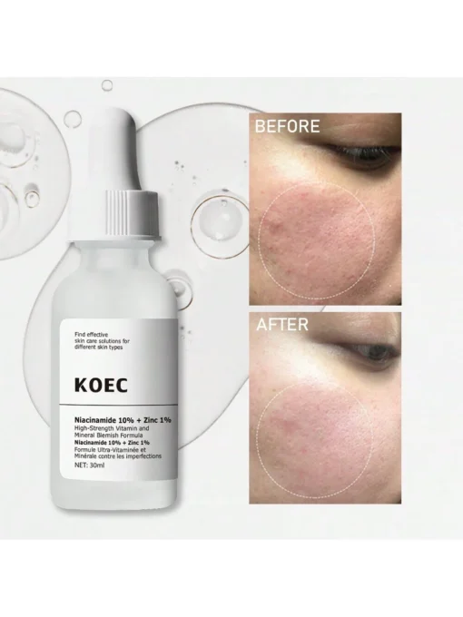 SHEIN KOEC Niacinamide 10% + Zinc 1% Facial Serum 30ml