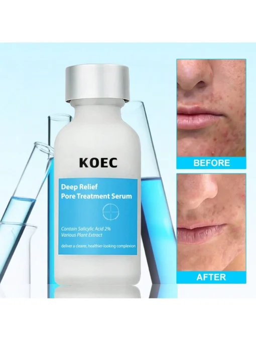 SHEIN KOEC Salicylic Acid Pore Care Face Serum