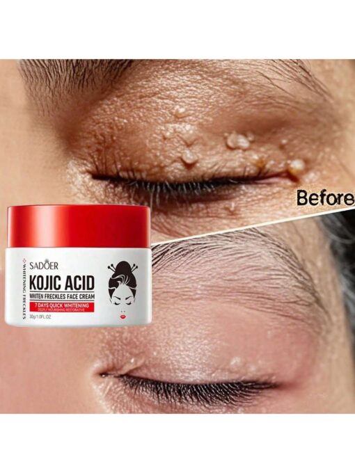 shein Whitening And Anti-Freckle Cream, Spot Removal - Image 2